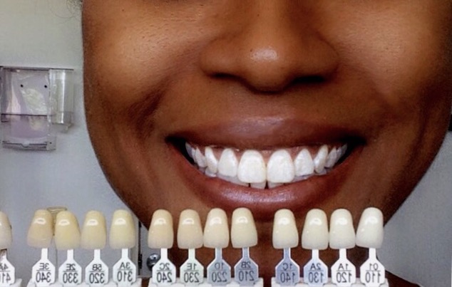 how many teeth does an the dental diet how many teeth do we need live lynnette how many teeth does an the dental diet how many teeth do we need live lynnette